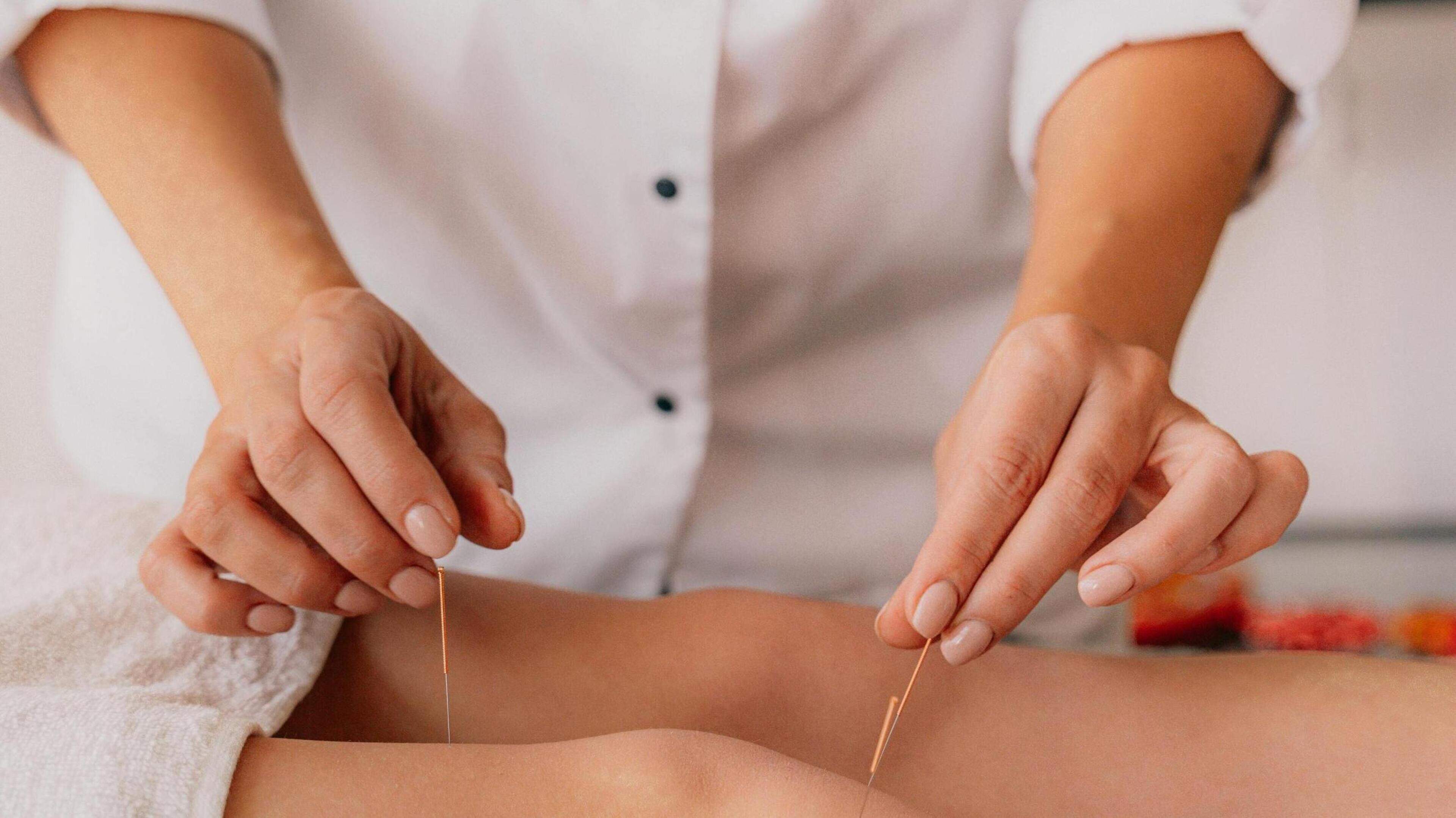 Acupuncture in Haarlem: ancient healing method, modern practice
